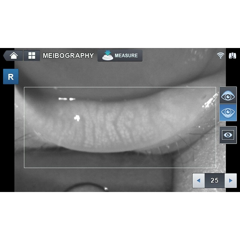 Meibography function