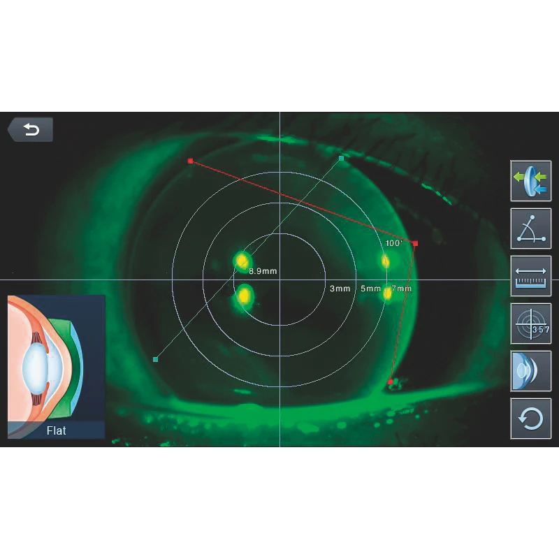 Detailed eye health analysis through IOL, RET-ILLUM Mode, and Color View Mode
