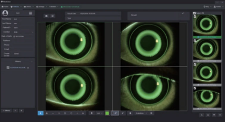 s390l firefly - Orthokeratology Lens Fitting Assistance