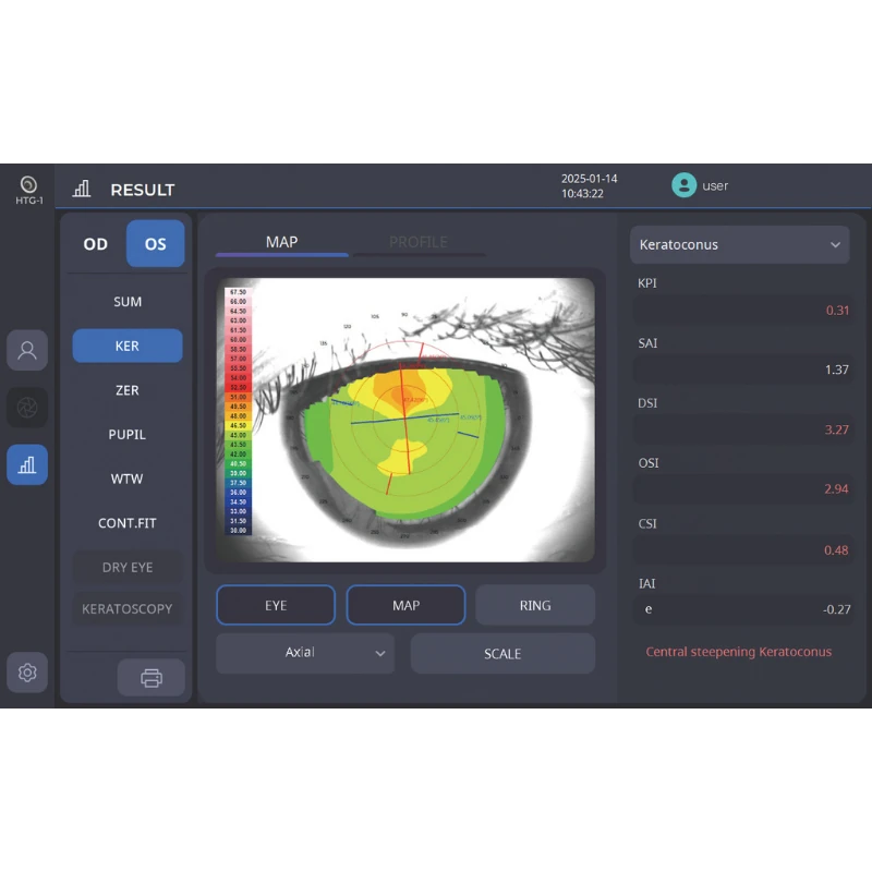 1.1 Comprehensive Corneal Data Acquisition